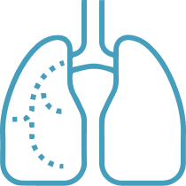 CHRONISCHE LONGZIEKTE pneumokokkenziekte icon